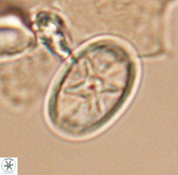 Eiffellithus turriseiffelii 10223