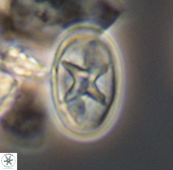 Eiffellithus turriseiffelii 10224