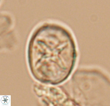 Eiffellithus turriseiffelii 10364