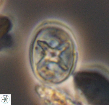 Eiffellithus turriseiffelii 10366