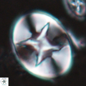 Eiffellithus turriseiffelii 16881
