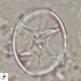 Eiffellithus turriseiffelii 16885