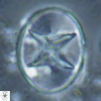 Eiffellithus turriseiffelii 16886