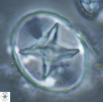 Eiffellithus turriseiffelii 16887