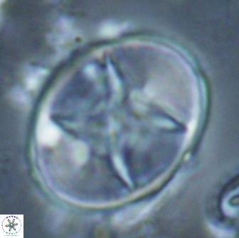 Eiffellithus turriseiffelii 16888