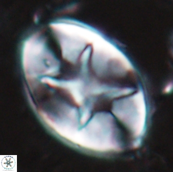 Eiffellithus turriseiffelii 16187