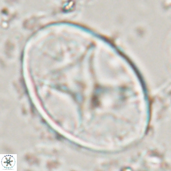 Eiffellithus turriseiffelii 16189