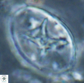 Eiffellithus turriseiffelii 16190