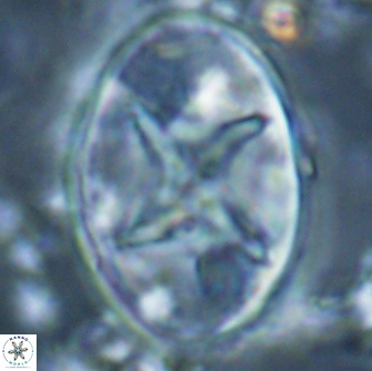 Eiffellithus turriseiffelii 16191
