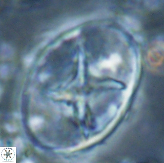 Eiffellithus turriseiffelii 16192