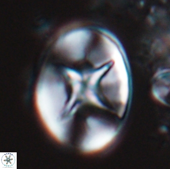 Eiffellithus turriseiffelii 17980