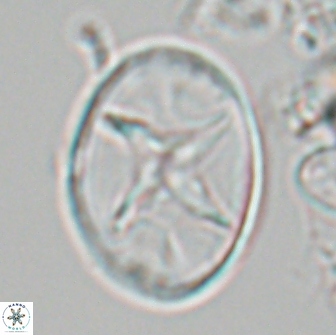 Eiffellithus turriseiffelii 17986