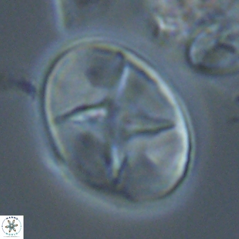 Eiffellithus turriseiffelii 17988