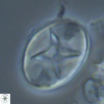 Eiffellithus turriseiffelii 17989