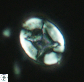 Eiffellithus turriseiffelii 3947