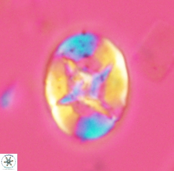 Eiffellithus turriseiffelii 3945