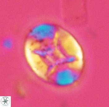 Eiffellithus turriseiffelii 3946