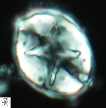 Eiffellithus turriseiffelii 4898