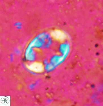Eiffellithus turriseiffelii 6030