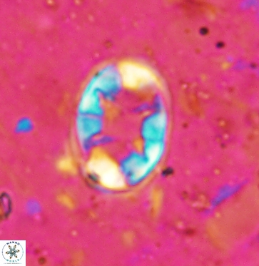 Eiffellithus turriseiffelii 6032