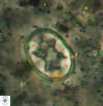 Eiffellithus turriseiffelii 6035