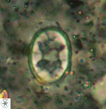 Eiffellithus turriseiffelii 6036