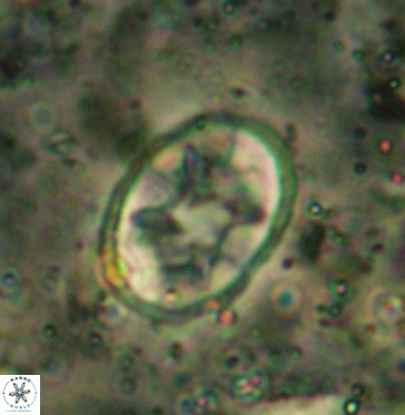 Eiffellithus turriseiffelii 6037