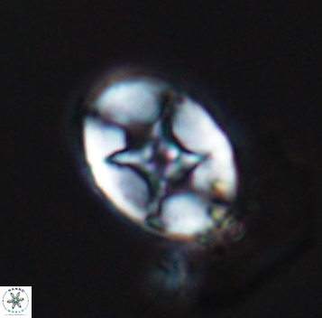 Eiffellithus turriseiffelii 9894