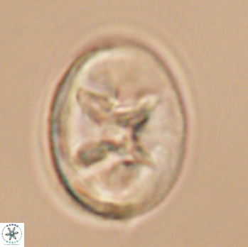 Eiffellithus turriseiffelii 9820