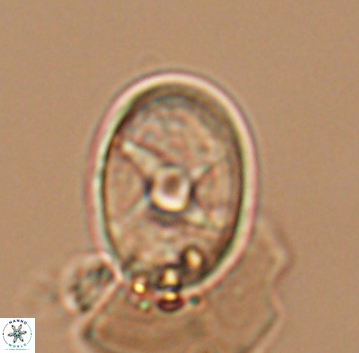 Eiffellithus turriseiffelii 9900