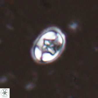 Eiffellithus vonsalisiae 28906