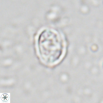 Eiffellithus vonsalisiae 28912
