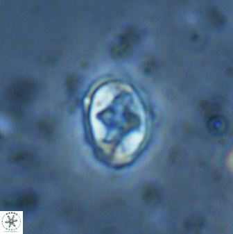Eiffellithus vonsalisiae 28913