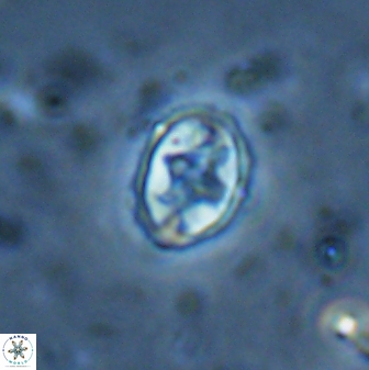 Eiffellithus vonsalisiae 28914