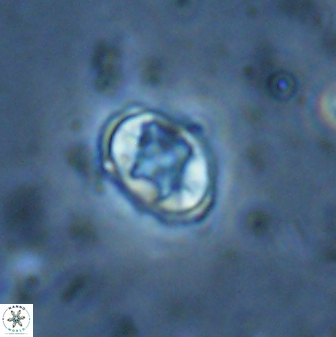 Eiffellithus vonsalisiae 28915