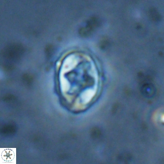 Eiffellithus vonsalisiae 28916