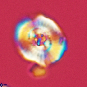 Ellipsagelosphaera clausa 3825