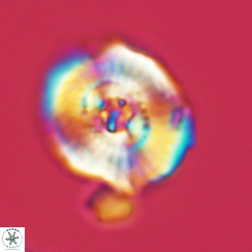 Ellipsagelosphaera clausa 3825