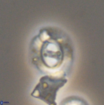 Ellipsagelosphaera gephyrocapsoides 9141