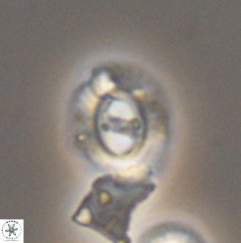 Ellipsagelosphaera gephyrocapsoides 9141