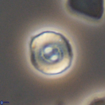 Ellipsagelosphaera lucasi 11114