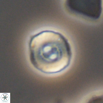 Ellipsagelosphaera lucasi 11114