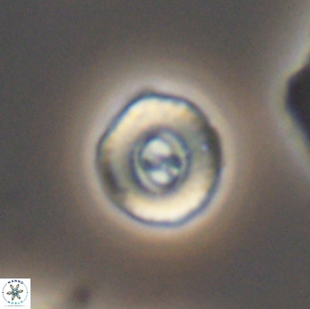 Ellipsagelosphaera lucasi 11115