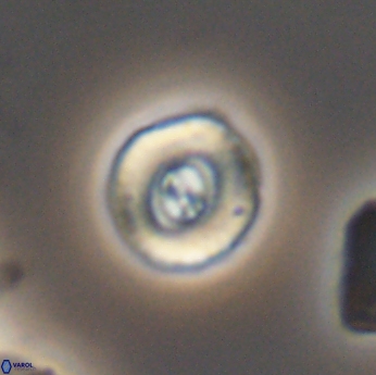 Ellipsagelosphaera lucasi 11116