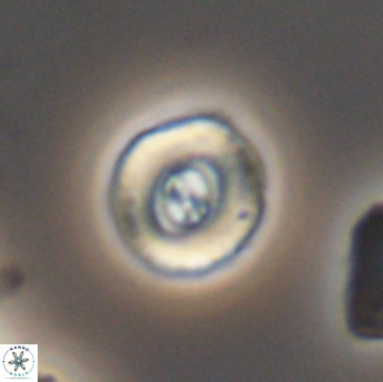 Ellipsagelosphaera lucasi 11116
