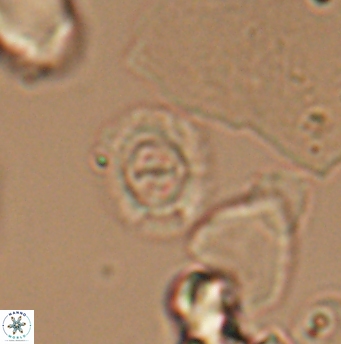 Ellipsagelosphaera lucasi 12867