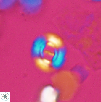 Ellipsagelosphaera lucasi 12871