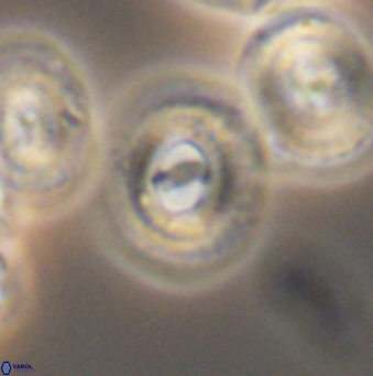 Ellipsagelosphaera gephyrocapsoides 9460
