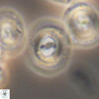 Ellipsagelosphaera gephyrocapsoides 9460