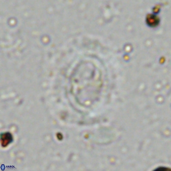 Ellipsagelosphaera lucasii 33160